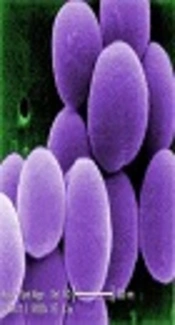 Standardization of Molecular Diagnostic of the entC and ent E <i>Staphylococcus aureus </i>Isolated from Human Infections in Zabol