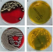Jundishapur J Microbiol