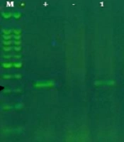 Gene Cell Tissue