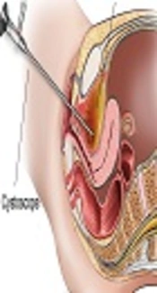 Cystoscopy, HMT Hospitals