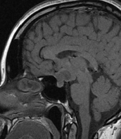 Int J Endocrinol Metab