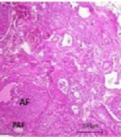 Int J Endocrinol Metab