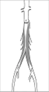 Two-Year Primary Patency Rates After Aortoiliac Occlusive Disease Endovascular Treatment