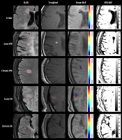 Archives of Neuroscience