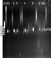 Jundishapur J Microbiol