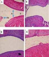Jundishapur J Nat Pharm Prod