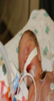 PortSaid Neonatology Group