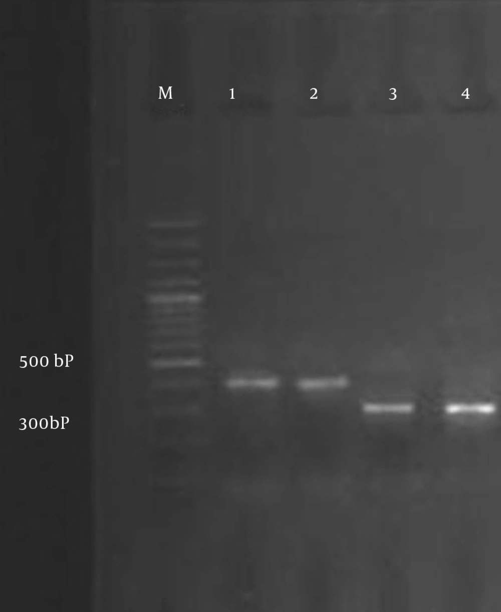 PCR Amplification of SHV and TEM Genes Lane M, 100 bp DNA marker; Lane 1, blaSHV from the positive control; Lane 2,<i>E. coli</i> clinical isolates expressing blaSHV; Lane 3, blaTEM from the positive control; Lane 4,<i>K. pneumonia</i> clinical isolates expressing blaTEM.