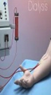 Prevalence and Risk Factors of Hepatitis B and C Virus Infections Among Patients Undergoing Hemodialysis in Kurdistan, Iraq