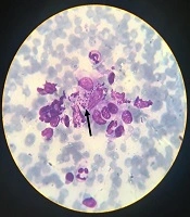 Jundishapur Journal of Microbiology