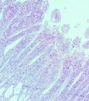 Jundishapur Journal of Natural Pharmaceutical Products