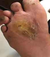  Journal of Skin and Stem Cell 