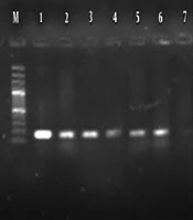 Jundishapur Journal of Microbiology