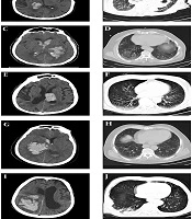 Archives of Clinical Infectious Diseases