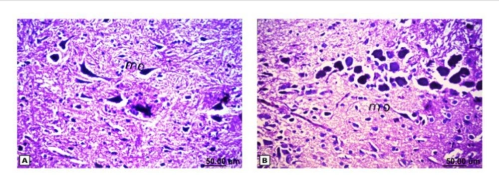 Histopathological results of rat brain area of medulla oblongata. (A) Normal control group: normal medulla oblongata structure. (B) Rat treated with i.v. nano-HAp after AlCl3: normal medulla oblongata structure