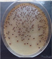 Jundishapur J Microbiol