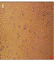 Jundishapur J Nat Pharm Prod