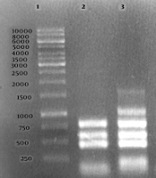 Jundishapur J Microbiol