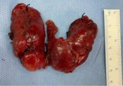Int J Endocrinol Metab