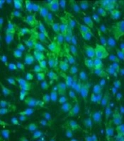 Jundishapur Journal of Microbiology
