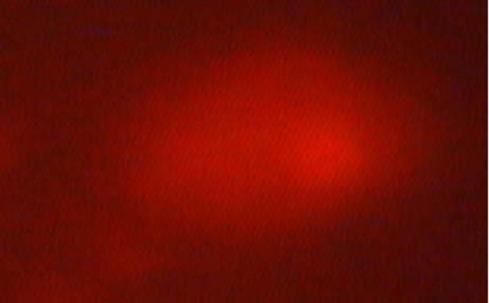 Microscopic Photograph 4 Score 3 Microscopic Photograph 4 Score 3