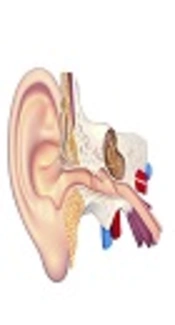 Treatment of Meniere’s Disease with Persian Medicine: A Case Report