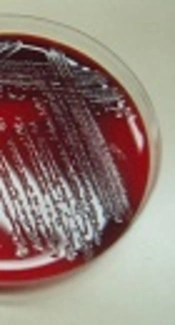 Epidemiological Aspects and Main Determinants of Prognosis in Children with <i>Acinetobacter</i> Infections Admitted to Intensive Care Units at Aliasghar Children's Hospital, Tehran, Iran