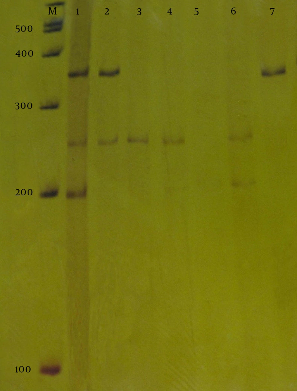Line M ladder 100 bp (Fermentas), Line 1 positive control (<i>S. aureus</i> ATCC 13353), line 2 isolates harboring <i>qacA/B </i>(361 bp) and <i>qacC </i>(247 bp), line 3 and 4 isolates harboring <i>qacC </i>(247 bp), line 5 isolates negative for qacs gene, line 6 isolates harboring <i>smr </i>(195 bp) and <i>qacC</i> (247 bp), line 7 isolates harboring <i>qacA/B </i>(361 bp). Line M ladder 100 bp (Fermentas), Line 1 positive control (<i>S. aureus</i> ATCC 13353), line 2 isolates harboring <i>qacA/B </i>(361 bp) and <i>qacC </i>(247 bp), line 3 and 4 isolates harboring <i>qacC </i>(247 bp), line 5 isolates negative for qacs gene, line 6 isolates harboring <i>smr </i>(195 bp) and <i>qacC</i> (247 bp), line 7 isolates harboring <i>qacA/B </i>(361 bp).