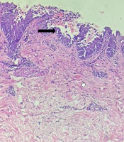 J Skin Stem Cell