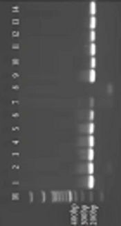 Molecular and Serological Evaluation of Toxoplasmosis in AIDS Cases in Southwest Iran