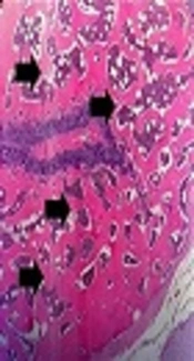 The Effect of Systemic Delivery of Bisphosphonates on Trabecular and Cortical Bone Mass of Ovariectomized Rats