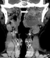 Iranian Journal of Radiology