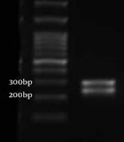 Jundishapur J Microbiol