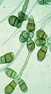 Isolation of Different Species of <i>Candida</i> in Patients with Vulvovaginal Candidiasis from Damavand, Iran