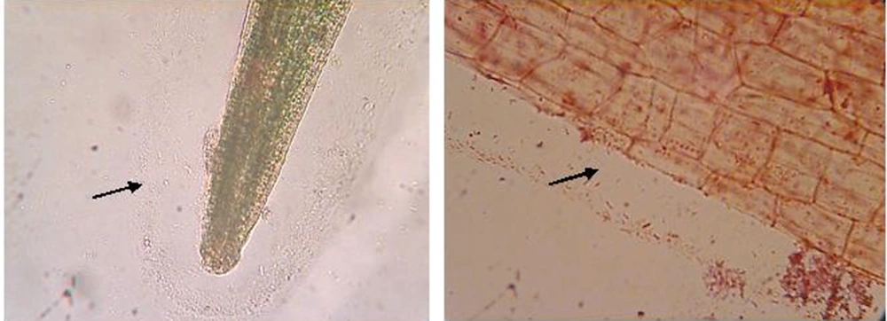 Pictures From Gram-Stained <i>L. minor</i> Roots Under a Nikon Microscope Using 40X and 100X Objectives Arrow shows a biofilm or thin layer around the roots with the presence of Gram-negative Bacilli