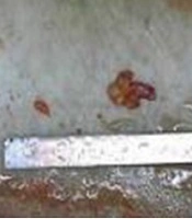 Iran J Radiol