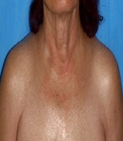 Journal of Skin and Stem Cell