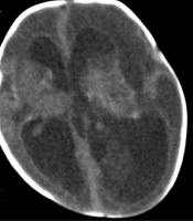Innov J Pediatr