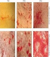 Gene Cell Tissue