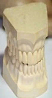 General Dentists’ Knowledge About Infection Control of Dental Impressions Between Clinic and Laboratory in South Khorasan Province