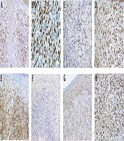Reports of Radiotherapy and Oncology