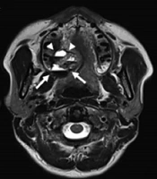 Iranian Journal of Radiology