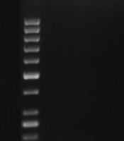 Jundishapur Journal of Microbiology