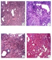 Jundishapur Journal of Natural Pharmaceutical Products