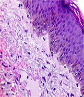 Journal of Skin and Stem Cell
