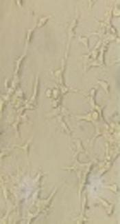 Novel Poly (ADP-Ribose) Polymerase Inhibitor AZD2461 Combined with Valproic Acid Exerts Mild Antagonistic Effects in Hela Cells