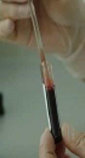 Detection of Occult Hepatitis B Virus Among Iranian HCV-Infected Patients with Hemophilia Treated with Direct-Acting Antiviral Agents