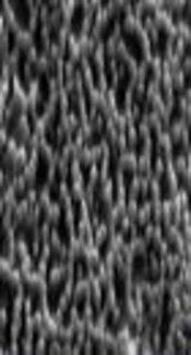 Evaluation of the Ability of Malassezia Species in Biofilm Formation