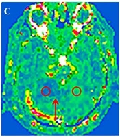 Iranian Journal of Radiology