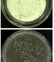 Jundishapur J Microbiol